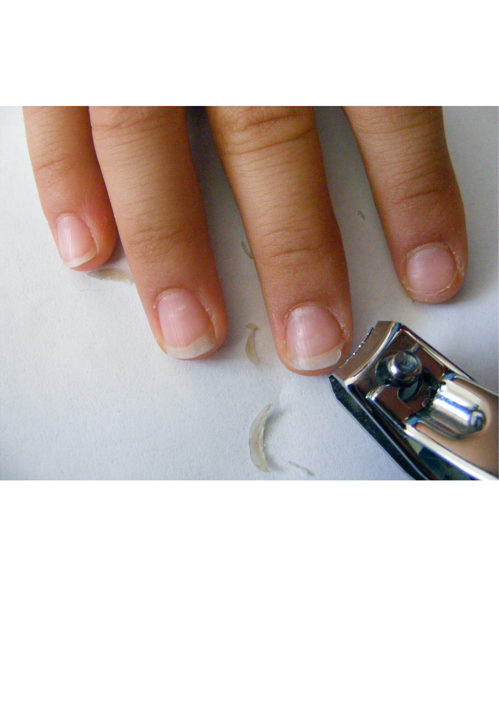 Mustard Seed Autism Support nail clipping resource